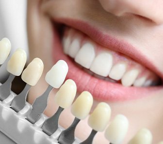 A dentist using a shade guide to assess a patient’s smile