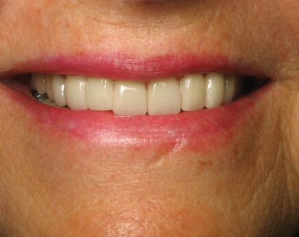 Healthy brilliant smile after dental treatment