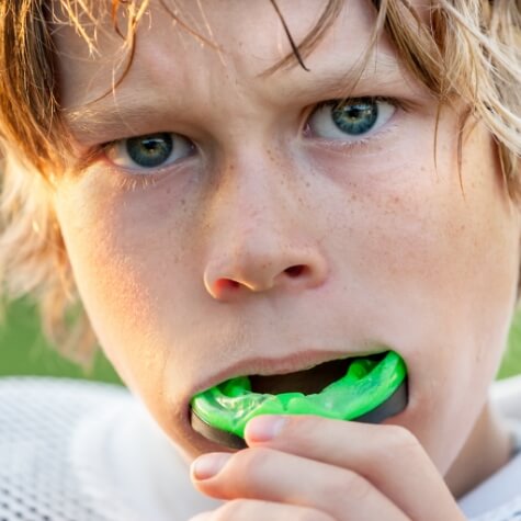 Teen placing athletic mouthguard