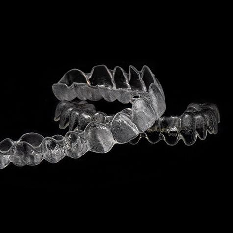 Two custom CandidPro aligners arranged against dark background