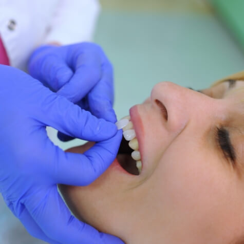 Dentist comparing patient's smile to dental bonding shades