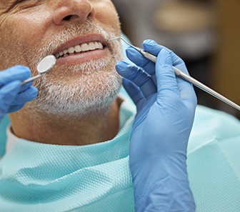 Nose-down view of man with white beard about to have dental exam