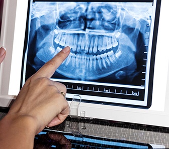 Glasses and pen on dental benefits claim form