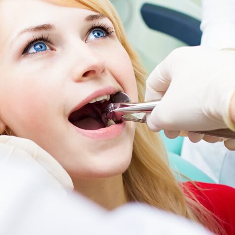 Patient receiving wisdom tooth extraction