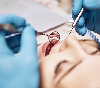 Closeup of woman having teeth examined by blue-gloved hands