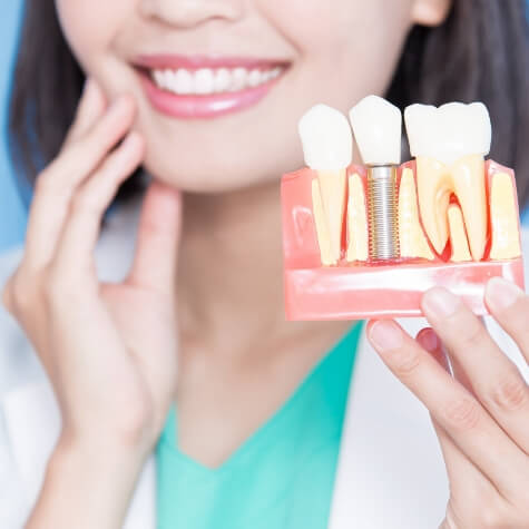 Dentist holding a dental implant supported dental crown