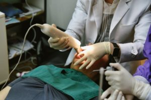 iTero scanner scanning teeth