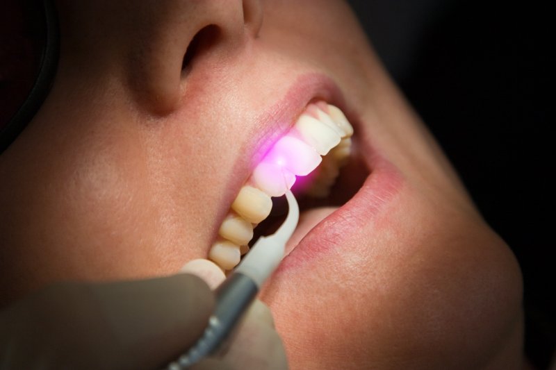 A closeup of a soft tissue laser used on a patient